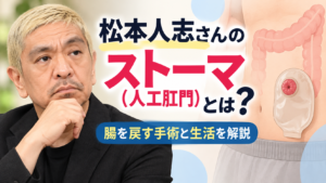 松本人志さんのストーマ（人工肛門）について、腸のイラストとストーマ装具を示し、「腸を戻す手術と生活を解説」と紹介する画像