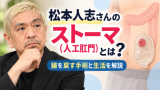 松本人志さんの「ストーマ（人工肛門）」とは？腸を戻す手術と生活を解説